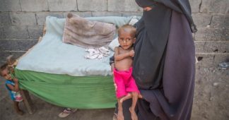 Yemen crisis: 85,000 children ‘dead from malnutrition’