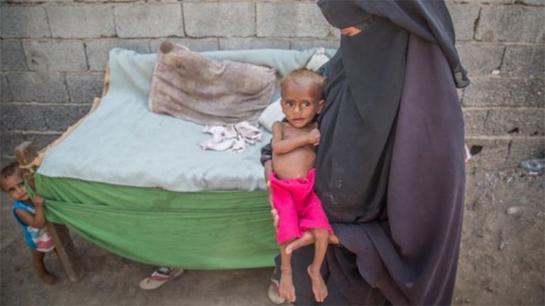 Yemen crisis: 85,000 children ‘dead from malnutrition’