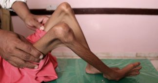 One civilian killed every three hours in Yemen: Oxfam