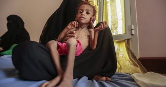 ‘Food Shouldn’t be a Weapon of War’: Charities Warn of US Complicity in Yemen