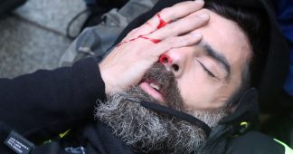 ‘I’ll lose my eye’: Prominent Yellow Vest activist suffers HORRIFIC injury in Paris protests