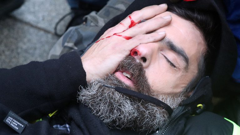 ‘I’ll lose my eye’: Prominent Yellow Vest activist suffers HORRIFIC injury in Paris protests