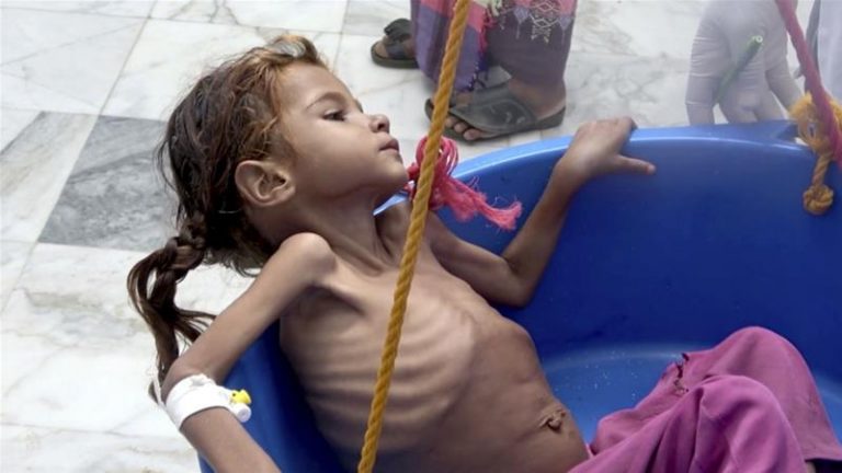 Yemen to face worst humanitarian crisis of 2019: UN