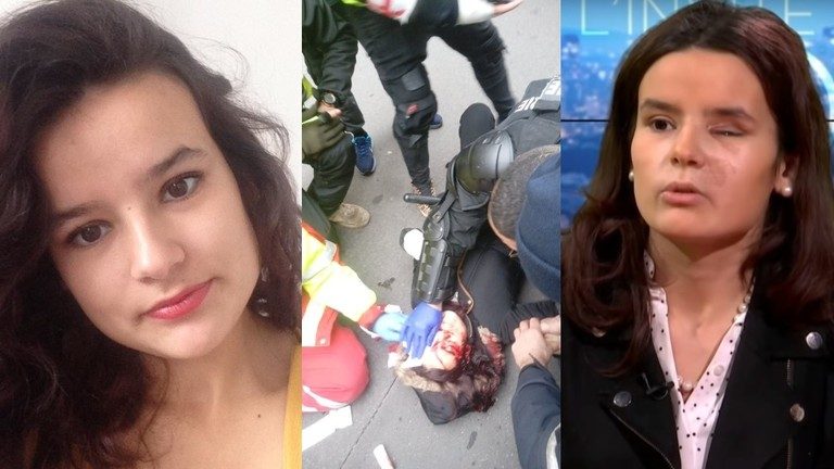 ‘I do not recognize my country’: Yellow Vests who have lost eyes, limbs demand justice from Macron