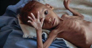 Hunger Games: Four Years Of Saudi/US Aggression In Yemen