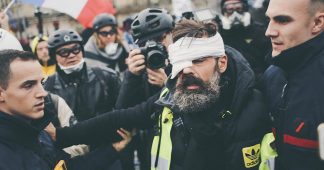 GILETS JAUNES: Die Verletzten, die verstören (Les blessés qui dérangent)