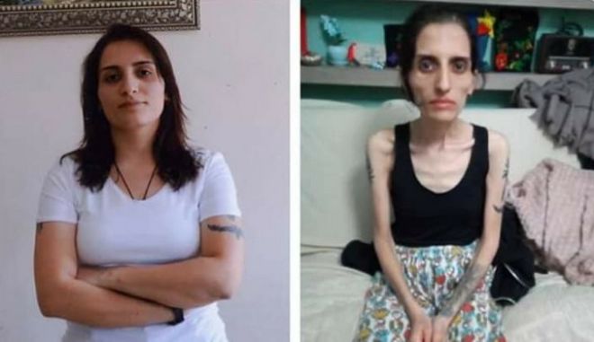 Member of banned Turkish folk group dies after hunger strike