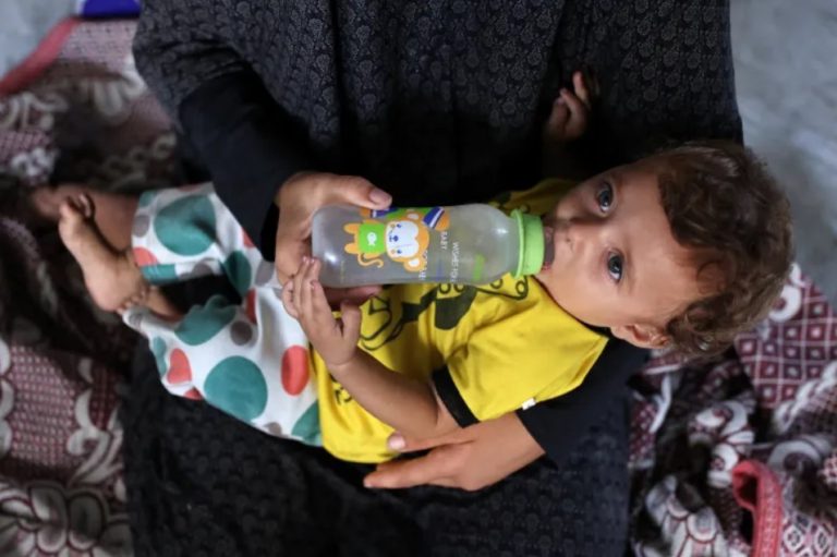 UN says every child under five in Gaza at risk of malnourishment