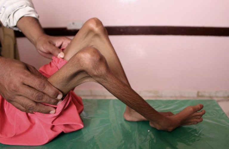 One civilian killed every three hours in Yemen: Oxfam