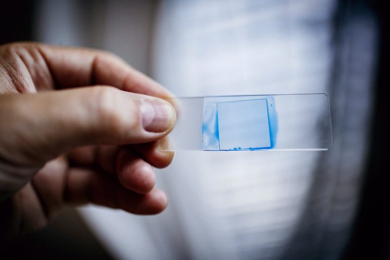 A Mysterious Infection, Spanning the Globe in a Climate of Secrecy