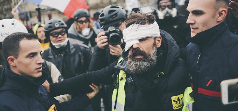 GILETS JAUNES: Die Verletzten, die verstören (Les blessés qui dérangent)