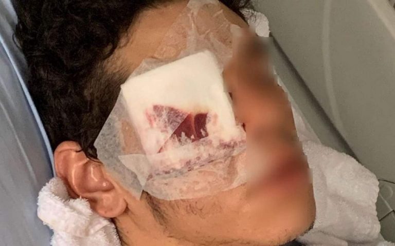 Adnane ,19 ans, mutilé, par la police