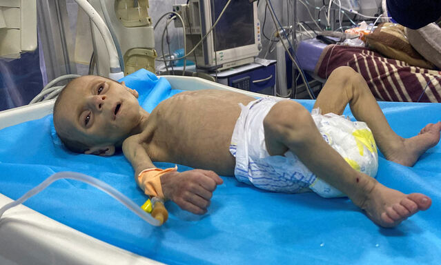 Just skin and bone: The starving Gaza children kept in incubators as UN human rights chief warns Israel may be guilty of war crime if it has cut off food aid