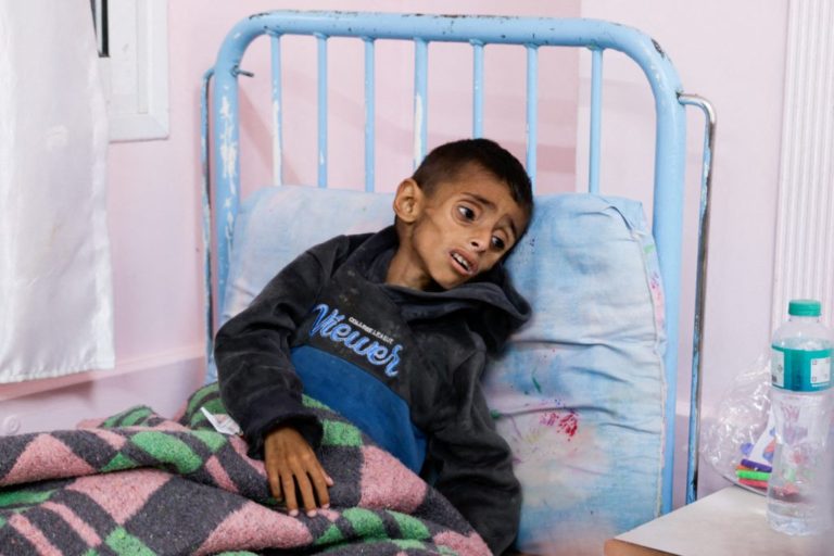 Israeli Strikes Kill 17 in Gaza as Children Starve Under Blockade