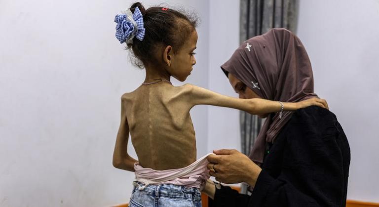 Situation in Gaza ‘beyond catastrophic’, UN says