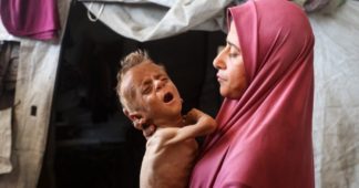 Israeli Doctors Say Gaza Children Are Starving Due to Israel’s Blockade, Not Because of Pre-Existing Medical Conditions