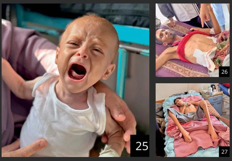 Starvation Is Everywhere’: Virtual Tours of Gaza Clinics Expose the Scale of the Horror