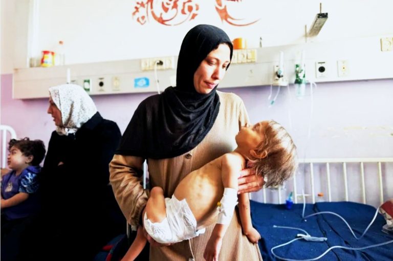 90% of Gaza’s Population faces malnutrition amid severe aid restrictions, UN warns