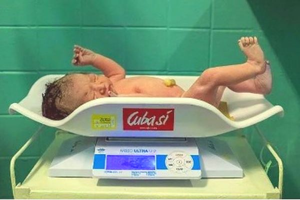 US Sanctions and the Sharp Rise in Infant Mortality in Cuba